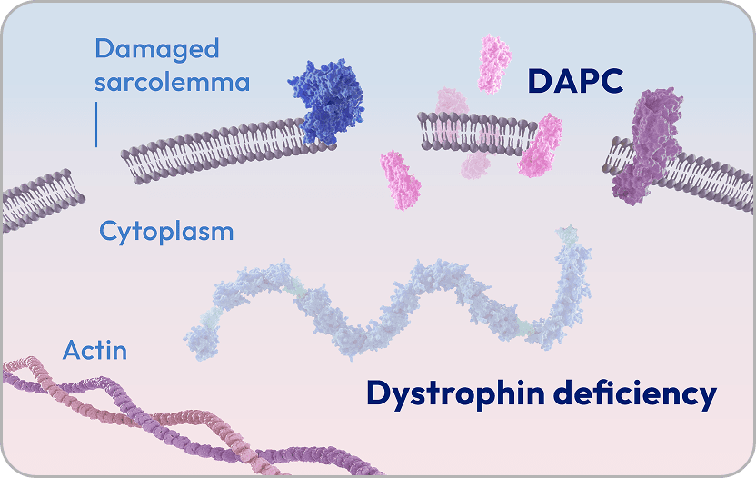 Image of muscle in Duchenne muscular dystrophy without dystrophin